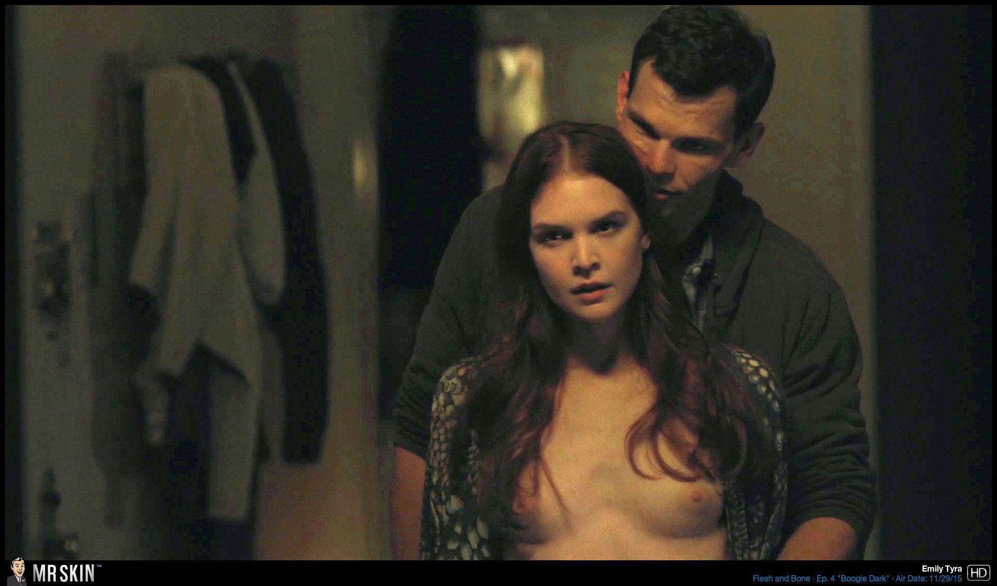 Tv Nudity Report The Affair Casual The Knick And Flesh And Bone